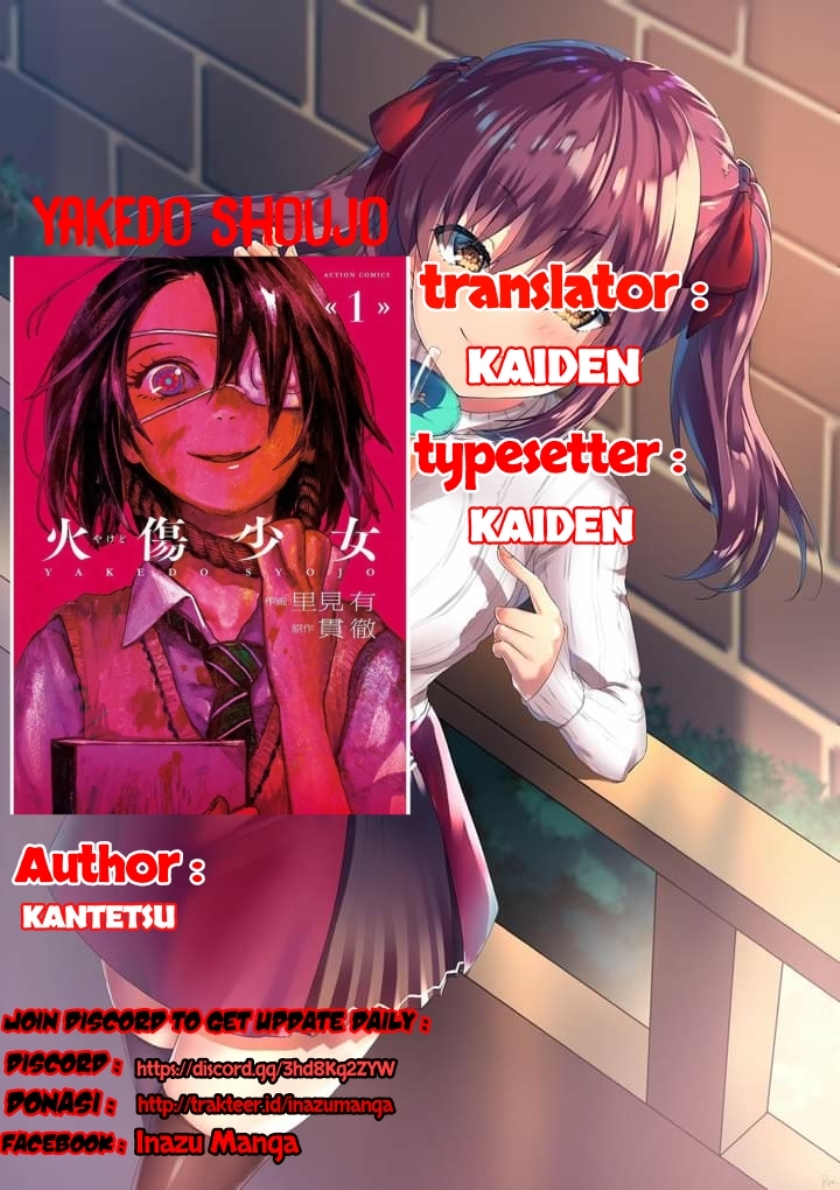 yakedo-shoujo - Chapter: 3