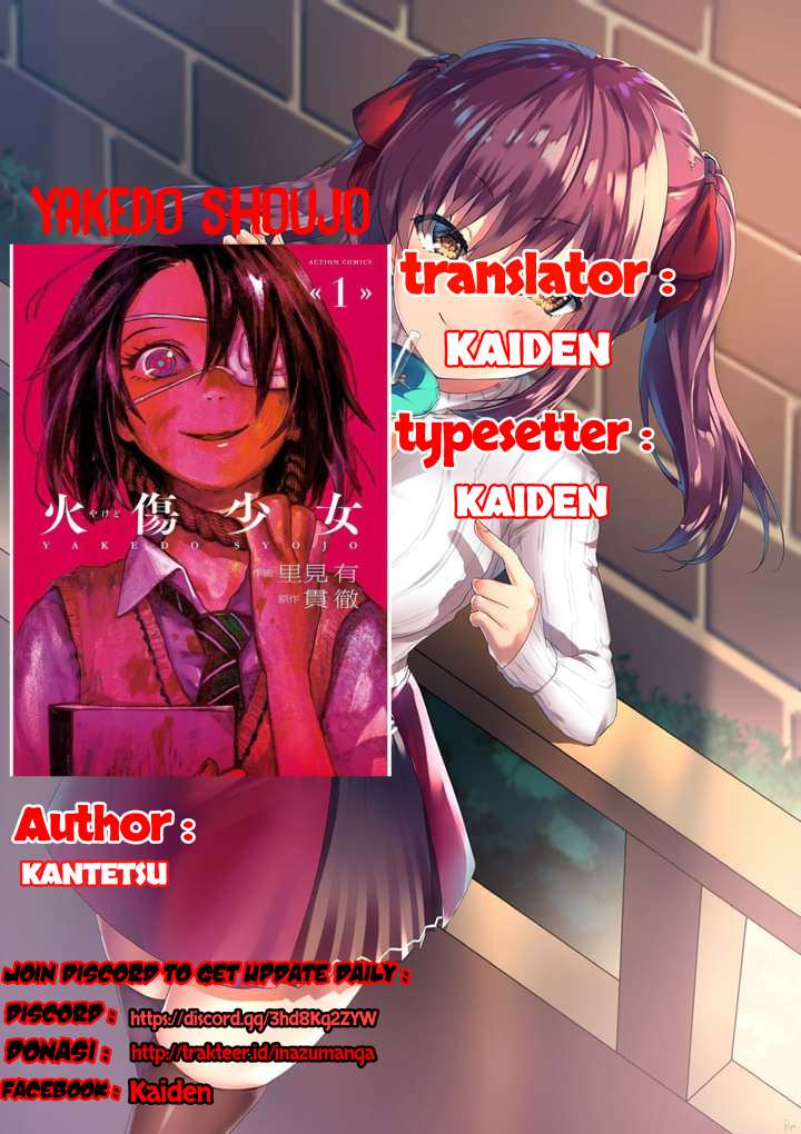 yakedo-shoujo - Chapter: 4